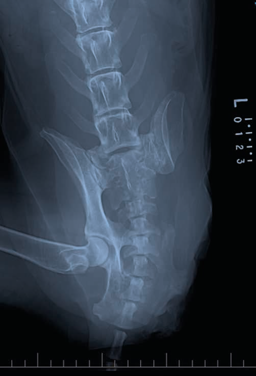 Figure 1 Hemipelvectomy
